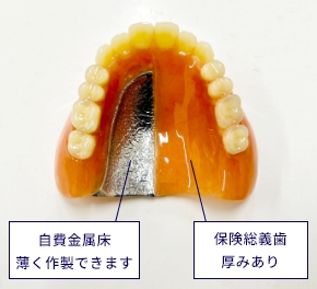 入れ歯の写真